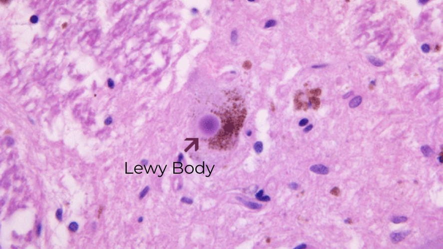 The role of microbiome in human health and diseases - The role of microbiome in human health and diseases