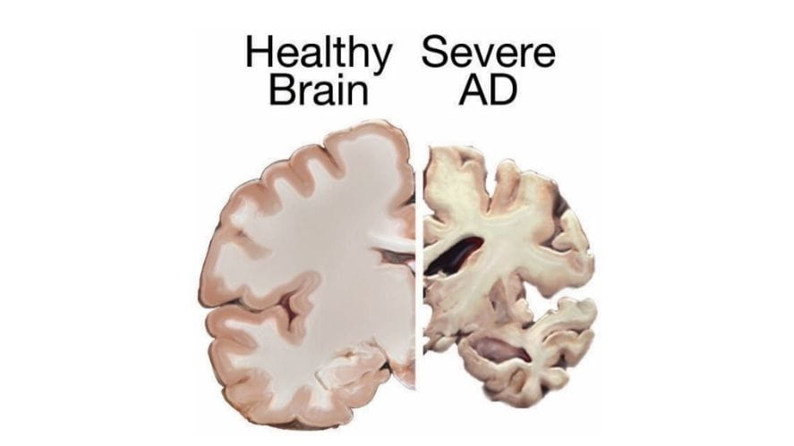 The role of microbiome in human health and diseases - The role of microbiome in human health and diseases